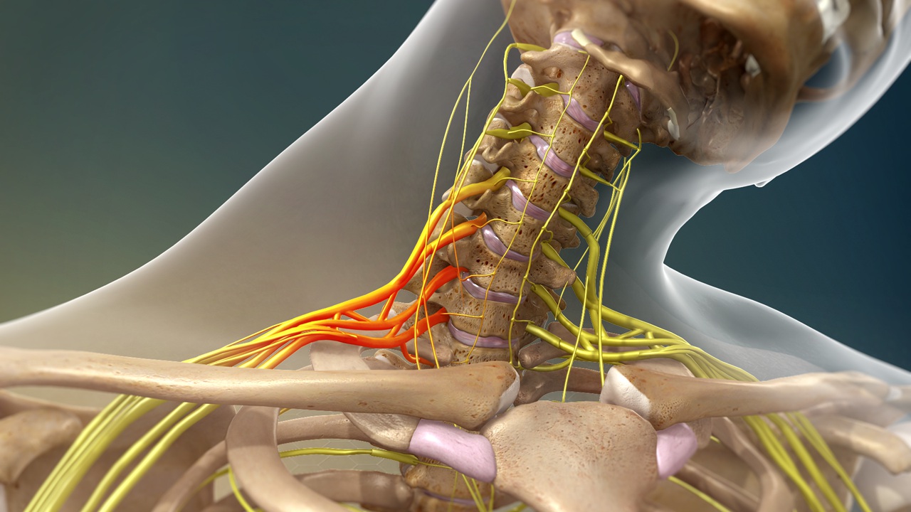 Neck stingers and hip pointers