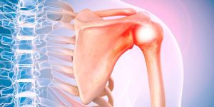 Shoulder joint