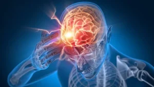 Concussion treatment, Tigard